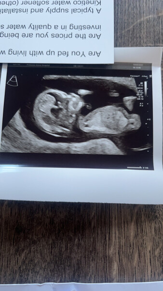 Due February 2023 ❤️💙💛💖 Thread 2!