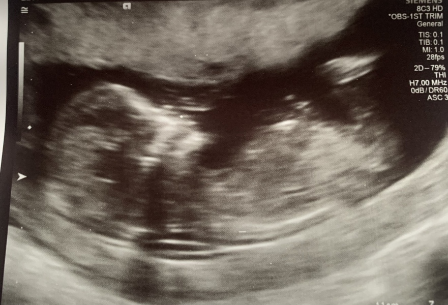 Due March 2023 - thread 2 
