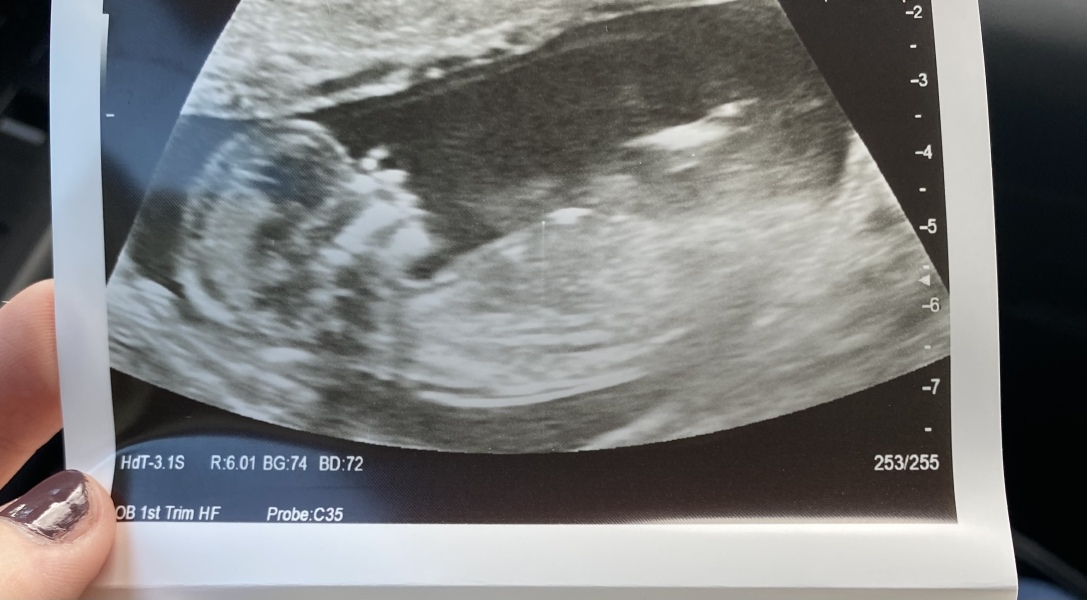 Due March 2023 - thread 2 