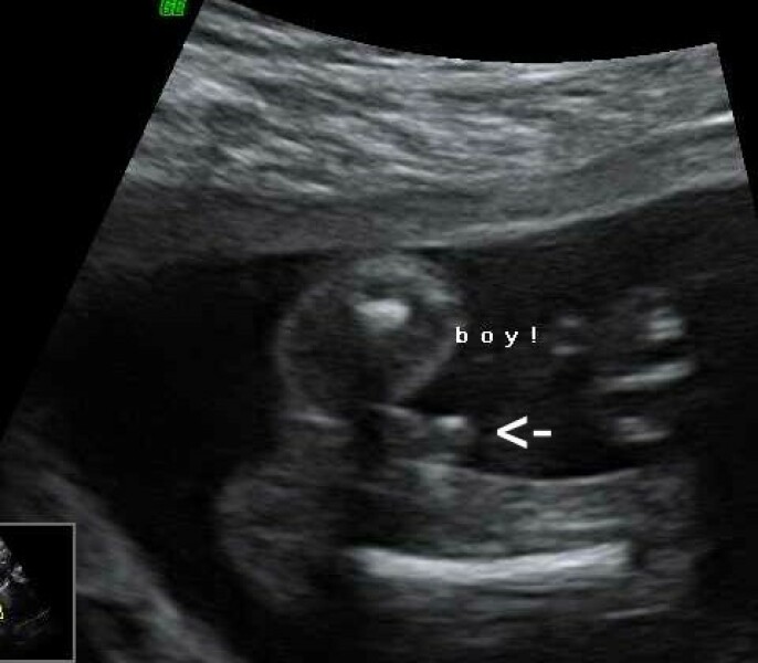 Scan