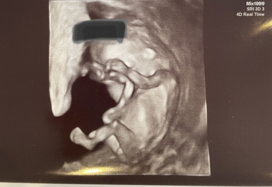 12 week scan a week today, shall I wait or go for Harmony today?