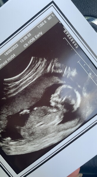 Mifepristone and major regret !! 