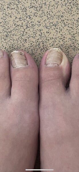 Can someone please tell me wtf is wrong with my toes