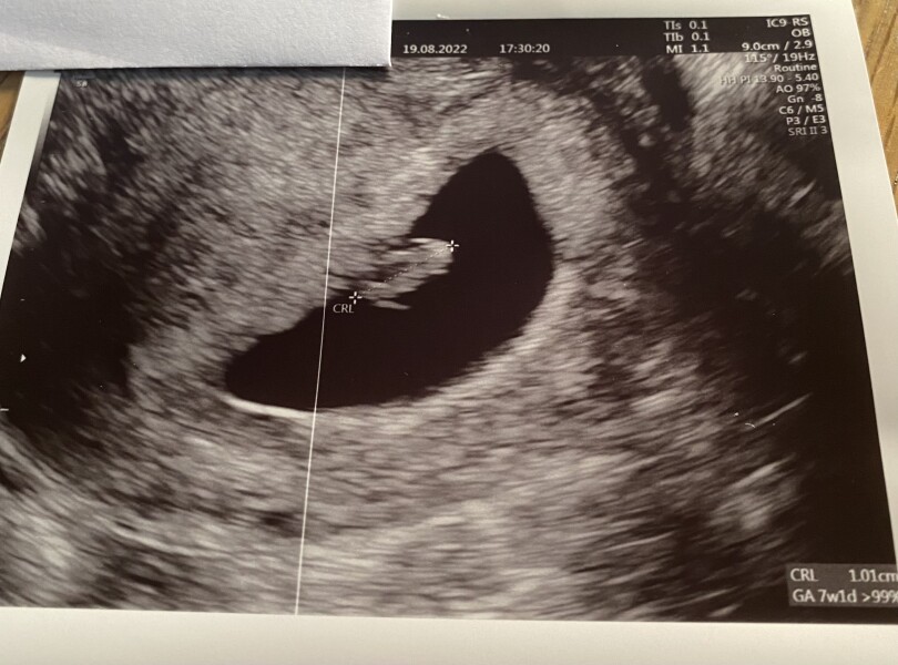 Babies due April 2023 thread 3