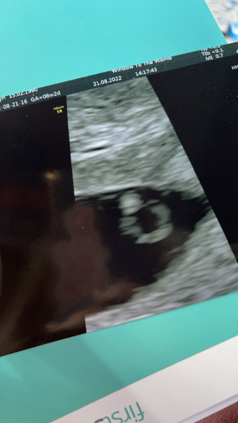 Babies due April 2023 thread 3