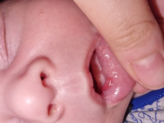 Cold sore or spot?
