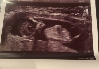 Any gender guesses from 13 week scan? 