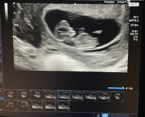 Due March 2023 - thread 2 