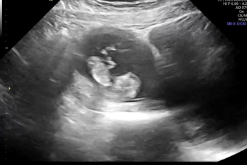 Due March 2023 - thread 2 