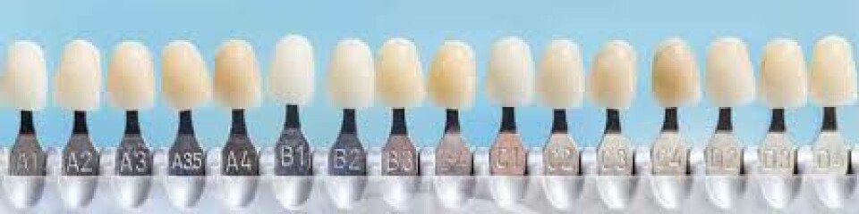AIBU to ask you to please help with implant teeth choice