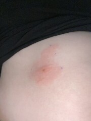 Bite getting bigger....