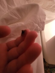 TW:Wart that looks like a maggot protruding put of finger 