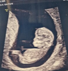 Any guesses?