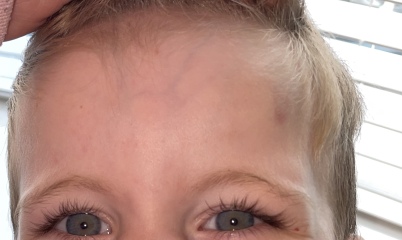 Leukaemia worry 