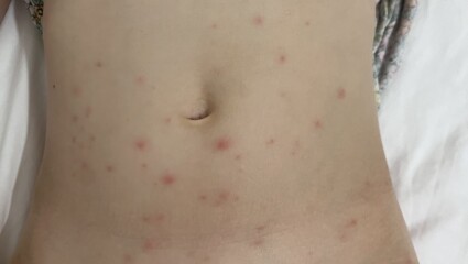 What are these spots - bed bugs?