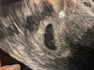 Confused about scans 6 weeks