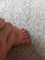 Advice please, baby toes