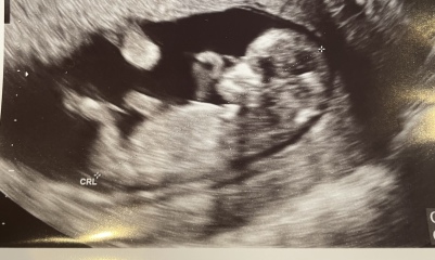 Boy or girl - Nub/skull guesses welcome :)
