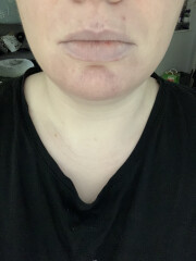 Why have my lips gone blue?!