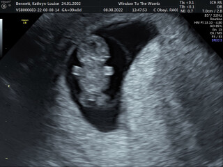 Due March 2023 - thread 2 