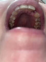 Can a dentist or anyone help please I’m not sure if I have dry socket