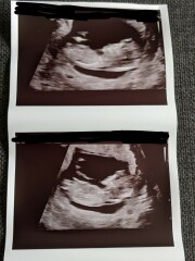 Due March 2023 - thread 2 