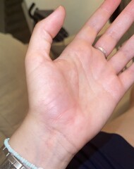 Any idea what this could be?!