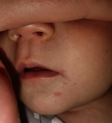 Is this a dribble rash or something else? Help a panicky FTM out!