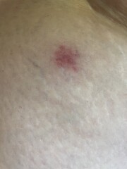 What is biting me?! With pics 