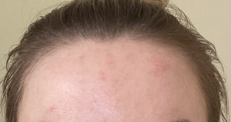 Anyone know what’s going on with my skin?