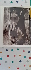 Nub theory guesses - for fun!