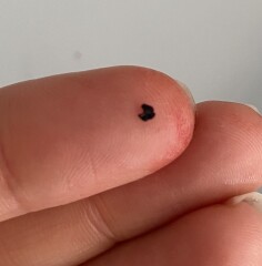 What the heck was on my skin?! 