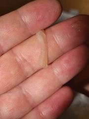 DISCHARGE oR MUCOUS PLUG?? 