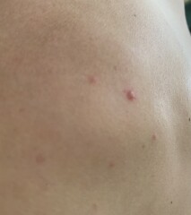 Anyone know what’s going on with my skin?