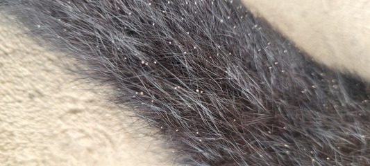 Treating Lice??