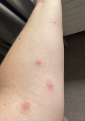 To be worried about this rash?