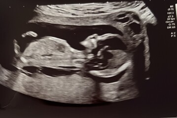 Help with gender guess