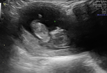 Due March 2023 - thread 2 