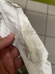 Implantation or infection?