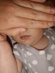 Is this a dribble rash or something else? Help a panicky FTM out!