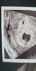 Babies due April 2023 thread 3