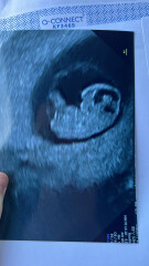 Due March 2023 - thread 2 
