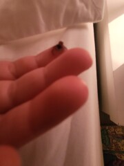 TW:Wart that looks like a maggot protruding put of finger 