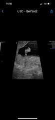 Due March 2023 - thread 2 