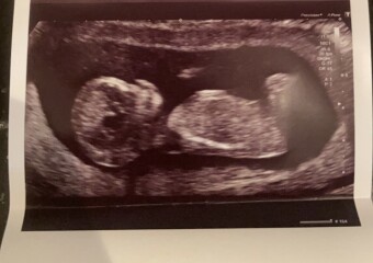 Any gender guesses from 13 week scan? 