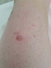 Strange lump pic included 