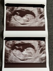 Due March 2023 - thread 2 
