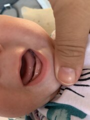 Is he teething?