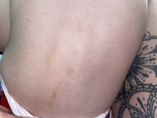 Leukaemia worry 