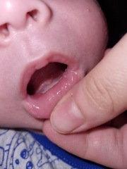 Cold sore or spot?